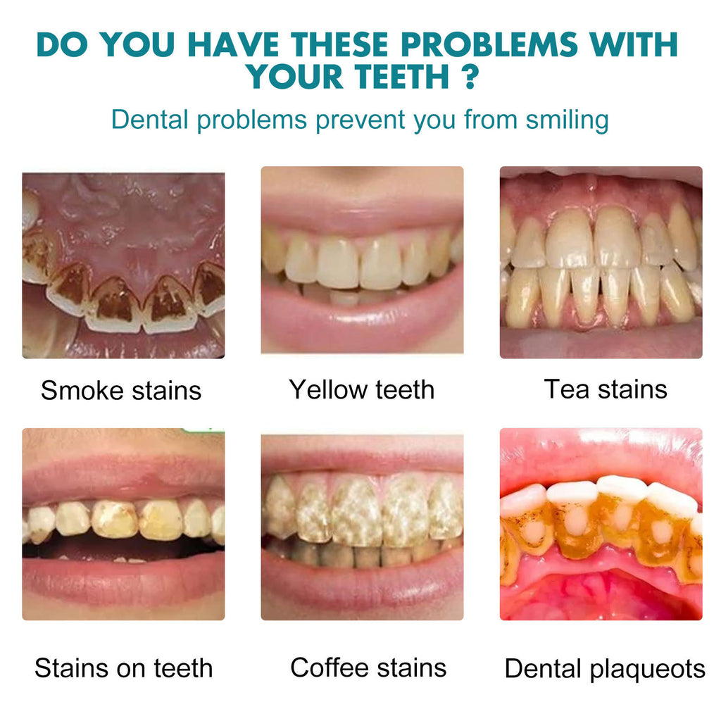 Teeth Cleaning Dental Paint 15mL