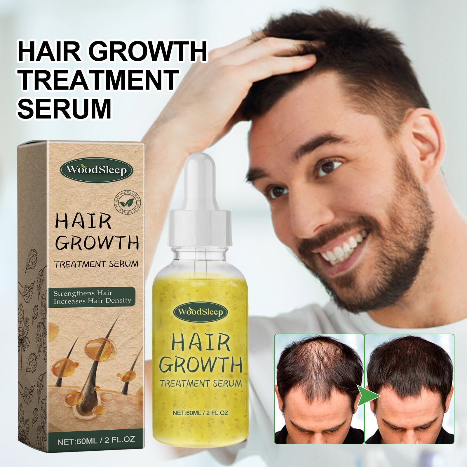 WoodSleep Hair Care Essential Oil – Nourishing Scalp & Strand Therapy