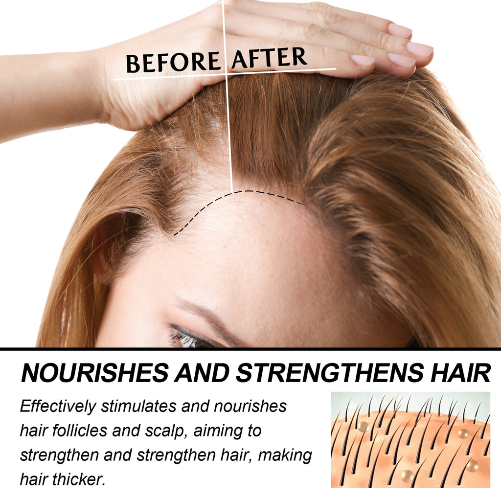 WoodSleep Hair Care Essential Oil – Nourishing Scalp & Strand Therapy