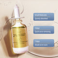 Acne Removing Salicylate Facial Essence